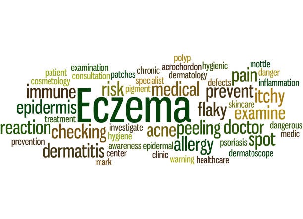 Eczema Facts